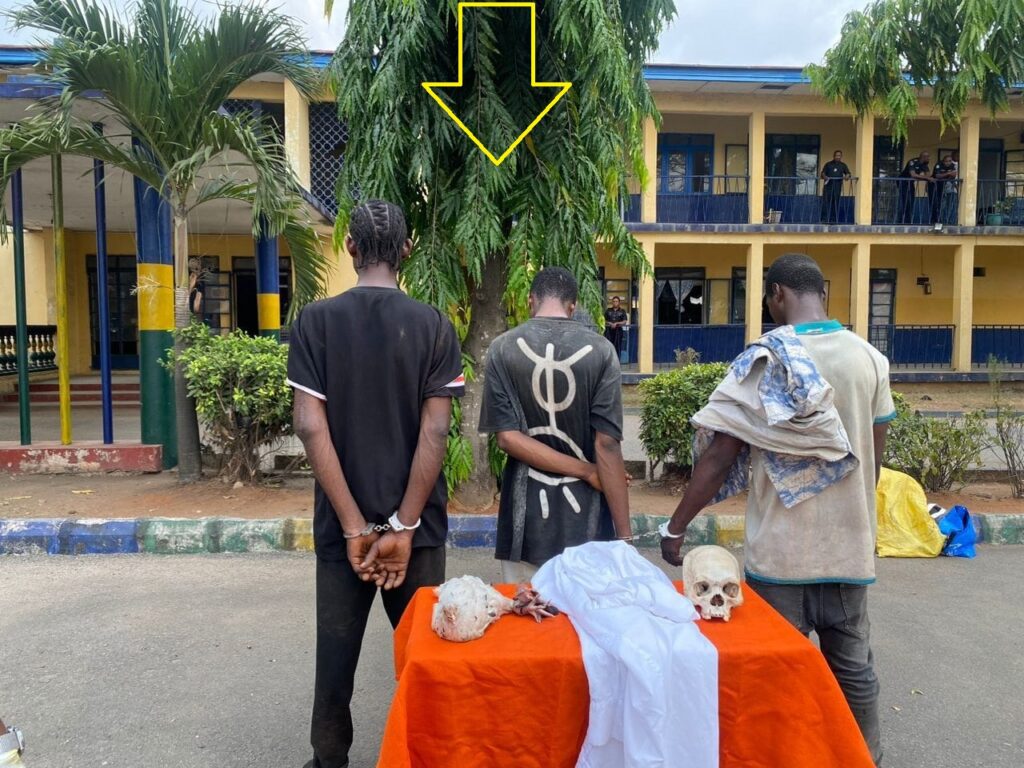 Police Arrest Three with Human Skull in Imo, Plan DNA Test to Identify Victim